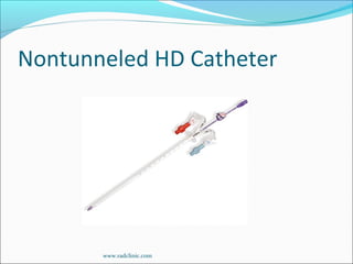 Nontunneled HD Catheter
www.radclinic.com
 