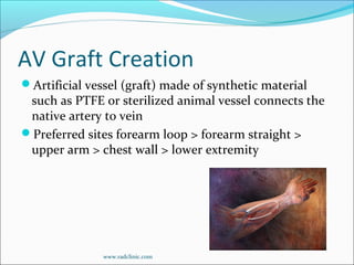 AV Graft Creation
Artificial vessel (graft) made of synthetic material
such as PTFE or sterilized animal vessel connects the
native artery to vein
Preferred sites forearm loop > forearm straight >
upper arm > chest wall > lower extremity
www.radclinic.com
 