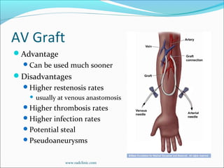 AV Graft
Advantage
Can be used much sooner
Disadvantages
Higher restenosis rates
 usually at venous anastomosis
Higher thrombosis rates
Higher infection rates
Potential steal
Pseudoaneurysms
www.radclinic.com
 