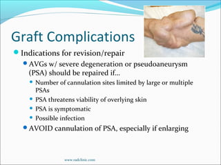 Graft Complications
Indications for revision/repair
AVGs w/ severe degeneration or pseudoaneurysm
(PSA) should be repaired if…
 Number of cannulation sites limited by large or multiple
PSAs
 PSA threatens viability of overlying skin
 PSA is symptomatic
 Possible infection
AVOID cannulation of PSA, especially if enlarging
www.radclinic.com
 