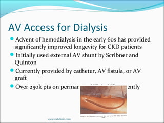 AV Access for Dialysis
Advent of hemodialysis in the early 60s has provided
significantly improved longevity for CKD patients
Initially used external AV shunt by Scribner and
Quinton
Currently provided by catheter, AV fistula, or AV
graft
Over 250k pts on permanent HD in US currently
www.radclinic.com
 