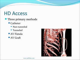 HD Access
Three primary methods
Catheter
 Non-tunneled
 Tunneled
AV Fistula
AV Graft
www.radclinic.com
 