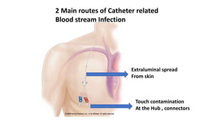 Dialysis in acute kidney injury | PPTX