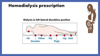Hemodialysis prescription
Dialysis in left lateral decubitus position
 