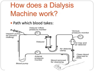 How does a Dialysis
Machine work?
 Path which blood takes:
 