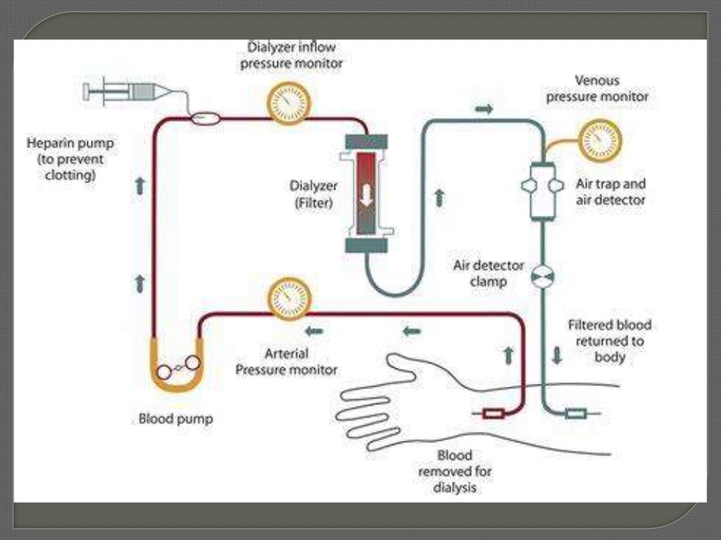Dialysis session management
