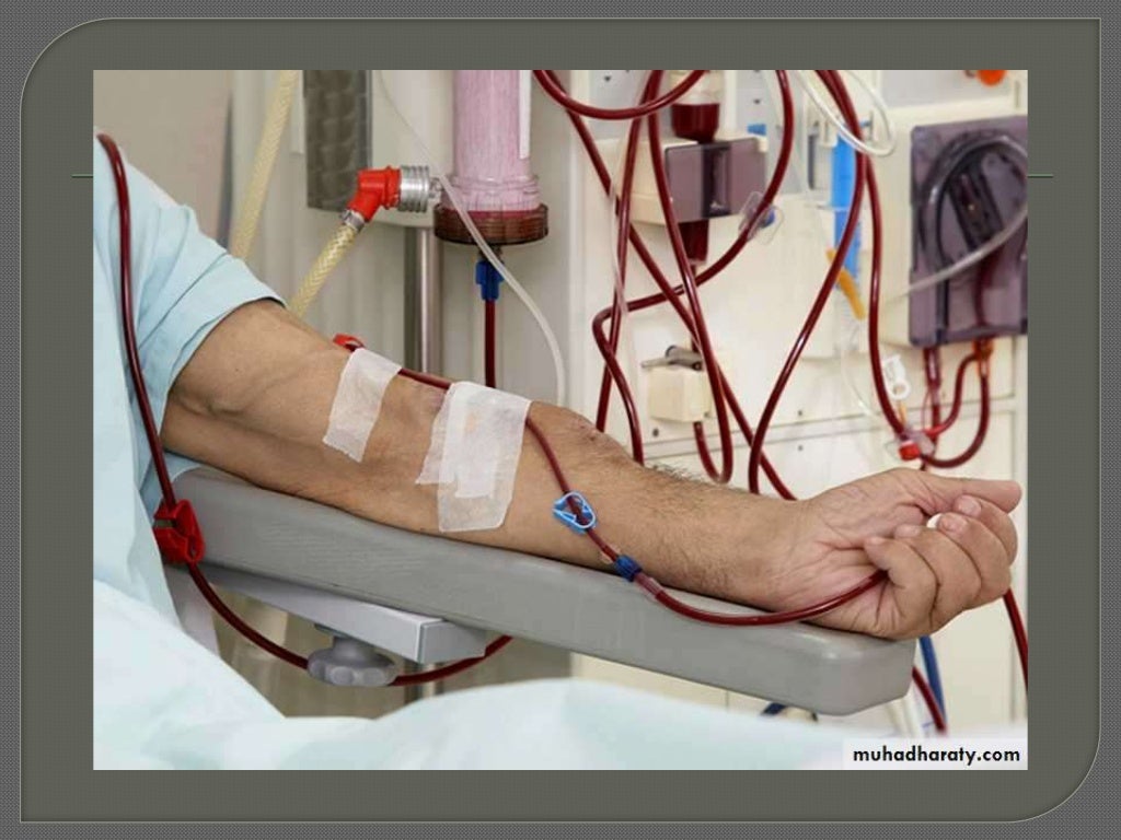 Dialysis session management