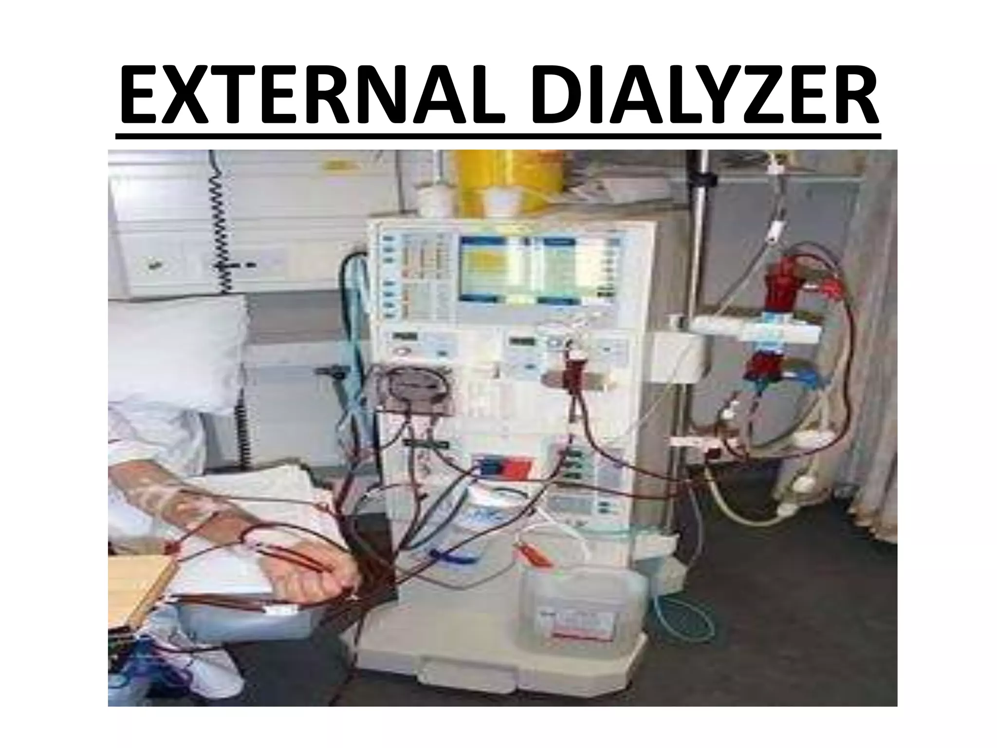 EXTERNAL DIALYZER
 