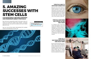 14 | PETER DIAMANDIS TOP 10 TECH TRENDS | 15
5. AMAZING
SUCCESSES WITH
STEM CELLS
I’VE INCREASINGLY BECOME CONFIDENT
AND PASSIONATE ABOUT STEM CELLS.
Stem cells are the regenerative engine of the body, to help cure
disease and extend the healthy human lifespan. I previously
wrote about stem cells and the incredible work from Dr. Robert
(Bob) Hariri here.
Here are my top three stories demonstrating the incredible
research and implications for stem cells.
RELATED READING
FORMOREONSTEMCELLS,CLICK
HERE TO CHECK OUT MY TECH
BLOG, STEM CELL REVOLUTION.
PHOTOS» p.15troke–Tewan Banditrukkanka/Shutterstock.com | Paralyzed Victim–USC
STEM CELLS ABLE TO
GROW NEW HUMAN EYES
Biologists led by Kohji Nishida at
Osaka University in Japan have
discovered a new way to nurture
and grow the tissues that make up
the human eyeball. The scientists
are able to grow retinas, corneas,
the eye’s lens, and more using
only a small sample of adult skin.
STEM CELL INJECTIONS
HELP STROKE VICTIMS
WALK AGAIN
In a Stanford study, of 18 stroke
victims who agreed to stem cells
treatments, 7 of them showed re-
markable motor function improve-
ments. This treatment could work
for other neurodegenerative con-
ditions such as Alzheimer’s disea-
se, Parkinson’s and Lou Gehrig’s
disease.
STEM CELLS
HELP PARALYZED VICTIM
GAIN USE OF ARMS
Doctors from the USC Neuroresto-
ration Center and Keck Medicine
of USC injected stem cells into the
damaged cervical spine of a re-
cently paralyzed 21-year-old man.
Three months later, he showed
dramatic improvement in sensa-
tion and movement of both arms.
 