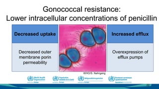 22
Decreased uptake
Decreased outer
membrane porin
permeability
Increased efflux
Overexpression of
efflux pumps
Gonococcal resistance:
Lower intracellular concentrations of penicillin
WHO/S. Nahrgang
 