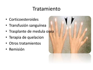 Tratamiento 
• Corticoesteroides 
• Transfusión sanguínea 
• Trasplante de medula osea 
• Terapia de quelacion 
• Otros tratamientos 
• Remisión 
