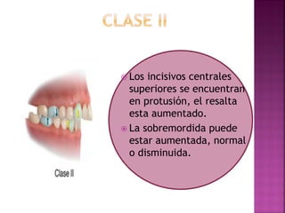  Los incisivos centrales
superiores se encuentran
en protusión, el resalta
esta aumentado.
 La sobremordida puede
estar aumentada, normal
o disminuida.
 