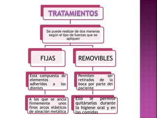 Se puede realizar de dos maneras
según el tipo de fuerzas que se
apliquen
FIJAS
Está compuesta de
elementos
adheridos a los
dientes
A los que se ancla
firmemente unos
finos arcos elásticos
de aleación metálica
REMOVIBLES
Permiten ser
retirados de la
boca por parte del
paciente
Ello le permite
quitárselos durante
la higiene oral y en
las comidas
 