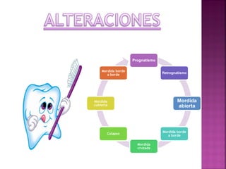 Prognatismo
Retrognatismo
Mordida
abierta
Mordida borde
a borde
Mordida
cruzada
Colapso
Mordida
cubierta
Mordida borde
a borde
 