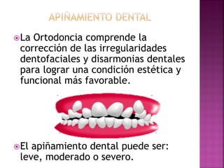 La Ortodoncia comprende la
corrección de las irregularidades
dentofaciales y disarmonias dentales
para lograr una condición estética y
funcional más favorable.
El apiñamiento dental puede ser:
leve, moderado o severo.
 