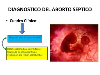 DIAGNOSTICO DEL ABORTO SEPTICO
• Cuadro Clínico:
Sangrado vaginal (ginecorragia)
Dolor espasmódico, intermitente,
localizado en el hipogastrio e
irradiación a la región sacrolumbar
 