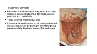 Diaper rash in pediatrics in small neonates | PDF