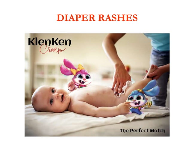 diaper rashes causes and treatment and prevention | PPTX | Parenting ...