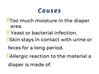 diaper rashes causes and treatment and prevention | PPTX