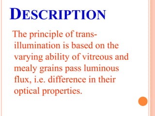 DESCRIPTION
The principle of trans-
illumination is based on the
varying ability of vitreous and
mealy grains pass luminous
flux, i.e. difference in their
optical properties.
 