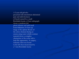 A 2-year-old girl who
presented with intermittent abdominal
pain and mild shortness
of breath caused by a small
Bochdalek hernia. a Chest radiograph
shows a moderate left
plural effusion and mild small
bowel dilatation. b Close-up
image of the splenic flexure of
the colon obtained during an
enema using water-soluble contrast
material shows a complete
obstruction of the colon with a
beak-like appearance. At surgery,
ischemic colon was found
in the left chest incarcerated by
a 7-mm Bochdalek hernia
 