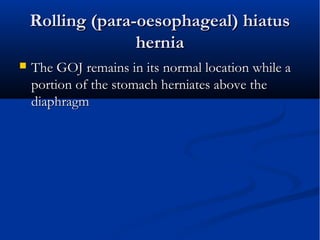 Rolling (para-oesophageal) hiatusRolling (para-oesophageal) hiatus
herniahernia
 The GOJ remains in its normal location while aThe GOJ remains in its normal location while a
portion of the stomach herniates above theportion of the stomach herniates above the
diaphragmdiaphragm
 