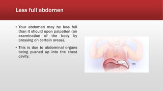 Less full abdomen
▪ Your abdomen may be less full
than it should upon palpation (an
examination of the body by
pressing on certain areas).
▪ This is due to abdominal organs
being pushed up into the chest
cavity.
 