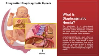 What is
Diaphragmatic
Hernia?
The diaphragm is a dome-shaped
muscular barrier between the chest and
abdominal cavities. It separates your heart
and lungs from your abdominal organs
(stomach, intestines, spleen, and liver).
A diaphragmatic hernia occurs when one
or more of your abdominal organs move
upward into your chest through a defect
(opening) in the diaphragm. This kind of
defect can be present at birth or acquired
later in life. It’s always a medical
emergency and requires prompt surgery to
correct.
 