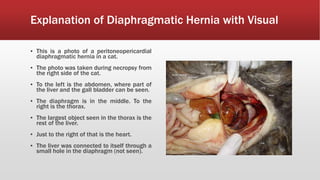 Explanation of Diaphragmatic Hernia with Visual
▪ This is a photo of a peritoneopericardial
diaphragmatic hernia in a cat.
▪ The photo was taken during necropsy from
the right side of the cat.
▪ To the left is the abdomen, where part of
the liver and the gall bladder can be seen.
▪ The diaphragm is in the middle. To the
right is the thorax.
▪ The largest object seen in the thorax is the
rest of the liver.
▪ Just to the right of that is the heart.
▪ The liver was connected to itself through a
small hole in the diaphragm (not seen).
 
