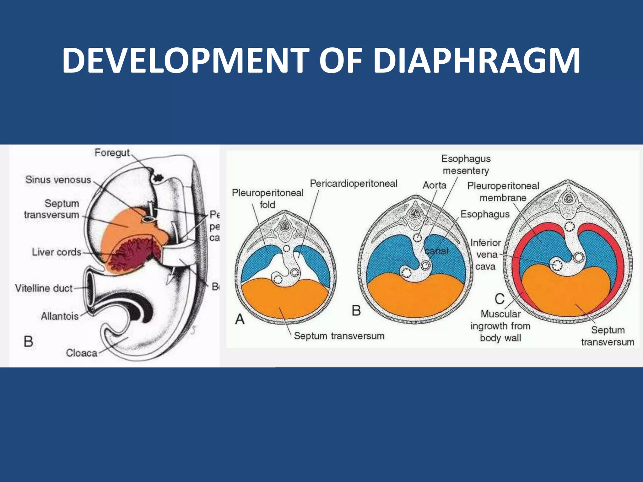 Diaphragmatic hernia | PPTX