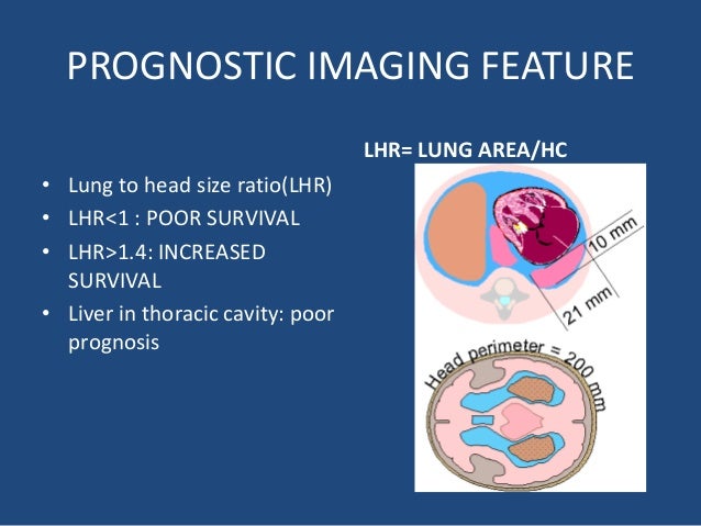 Diaphragmatic hernia