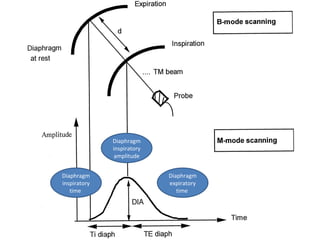 Diaphragm Timer Diaphragm Movement And Contractility Evaluation By Thoracic Ultrasound ...