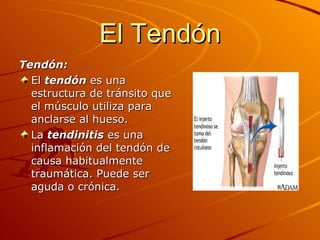 El Tendón <ul><li>Tendón: </li></ul><ul><li>El  tendón  es una estructura de tránsito que el músculo utiliza para anclarse...