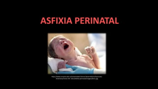 ASFIXIA PERINATAL
https://www.urosario.edu.co/Universidad-Ciencia-Desarrollo/ur/Fasciculos-
Anteriores/Tomo-VIII--2013/Asfixia-perinatal/images/dest1.jpg
 