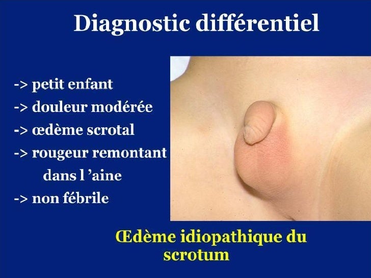 Diapo Epu Pediatrie Diapo Epu Pediatrie
