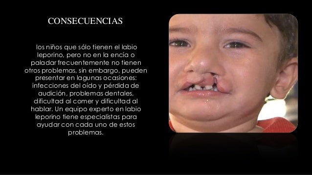 La pigmentación sobre la persona de las muchachas