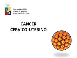 Universidad de Chile Facultad de Medicina Tecnología Médica 2010 CANCER CERVICO-UTERINO 