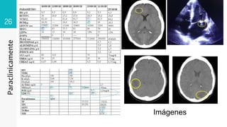 26
Paraclinicamente
Imágenes
 
