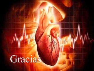 Gracias
 
