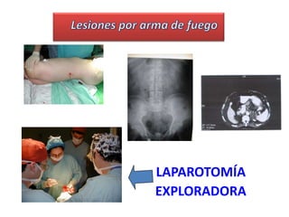 ProcedimientosdiagnósticosTraumatismos abiertos o penetrantesTraumatismos cerrados o contusos