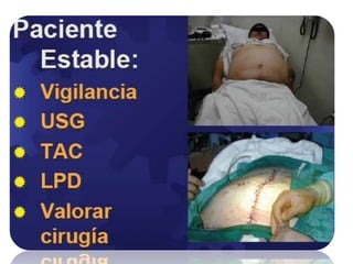 Lesiones por arma de fuegoLAPAROTOMÍAEXPLORADORA