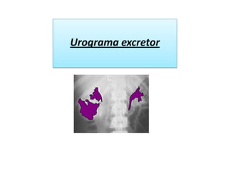 Tomografía axial computarizada