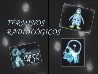 TÉRMINOS  RADIOLÓGICOS 