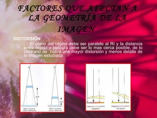 FACTORES QUE AFECTAN A LA GEOMETRÍA DE LA IMAGEN   DISTORSIÓN El plano del objeto debe ser paralelo al RI y la distancia entre objeto y película debe ser lo mas cerca posible, de lo contrario de  habrá una mayor distorsión y menos detalle de la imagen estudiada 