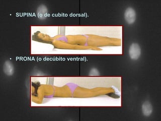 SUPINA (o de cubito dorsal). PRONA (o decúbito ventral). 