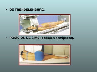 DE TRENDELENBURG . POSICION DE SIMS (posición semiprona). 