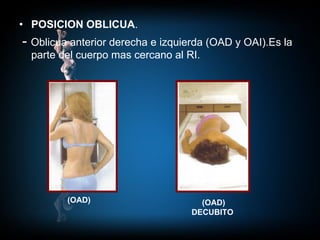 POSICION OBLICUA . -  Oblicua anterior derecha e izquierda (OAD y OAI).Es la parte del cuerpo mas cercano al RI.   (OAD) (OAD) DECUBITO 