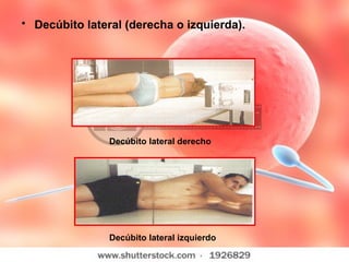 Decúbito lateral (derecha o izquierda).   Decúbito lateral derecho   Decúbito lateral izquierdo 