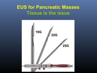 EUS for Pancreatic Masses
Tissue is the issue

19G

22G
25G

 