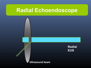 Radial Echoendoscope

Radial
EUS

Ultrasound beam

 